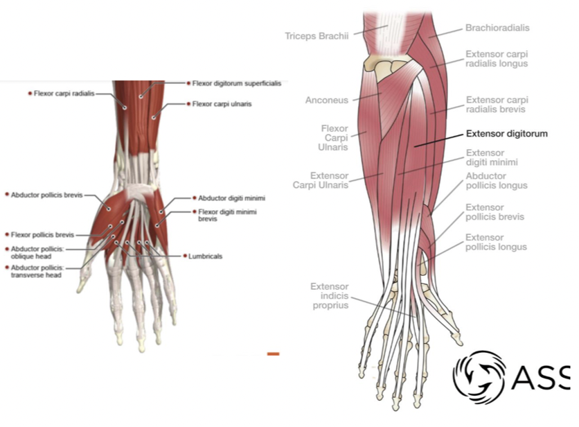 <p><strong> Flexors:</strong><br>• Flexor carpiradialis<br>• Flexor digitorium superficialis</p><p>• Flexor carpiulnaris</p><p><strong>Extensors:</strong><br>• Extensor carpiulnaris<br>• Extensor digitorum<br>• Extensor carpiradialis brevis (brevis means smaller)- to control baby finger</p><p>• Extensor digiti minimi- control baby finger<br>• Extensor pollicis longus*<br>• Abductor pollicis longus*</p><p>*help contribute to anatomical snuffbox</p><p>• Ligaments commonly injured related to supporting the carpal bones</p><p>*true and false #1 was TRUE</p><p>lumbricials help maintain bowl in the palm of your hand to suction you to a wall during rock climbing</p>