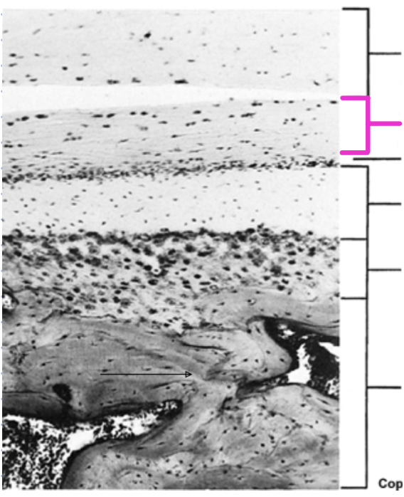 <p>Identify the histological structure of the adult mandibular condyle</p>