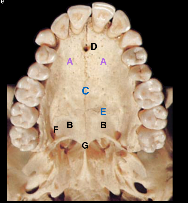 <p>label the parts of the hard palate </p>