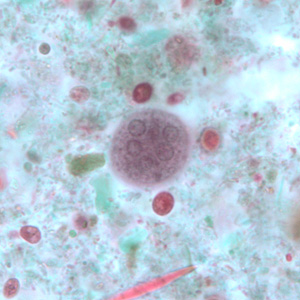 <p>four; 10-35 um</p>