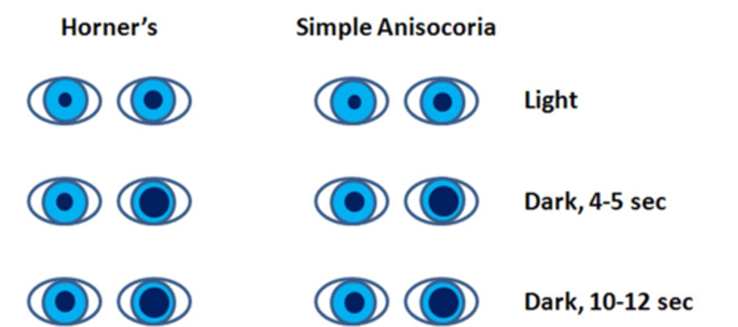 <p>use photos/video to compare pupil sizes in the dark at 5sec and 10sec</p>