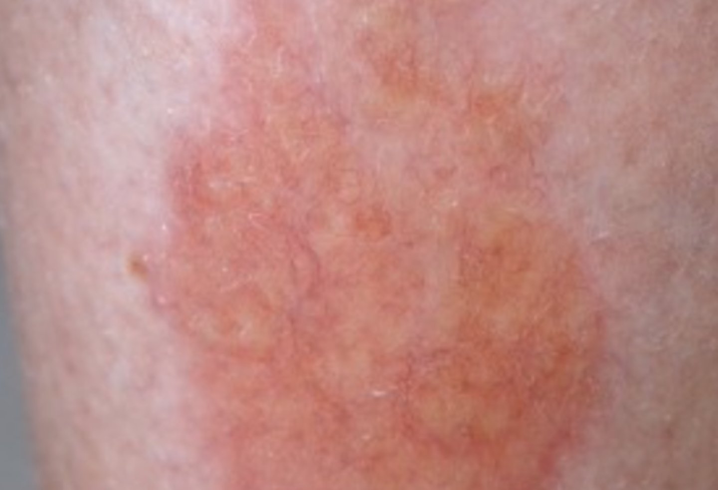 <p>What is the diagnosis?</p>