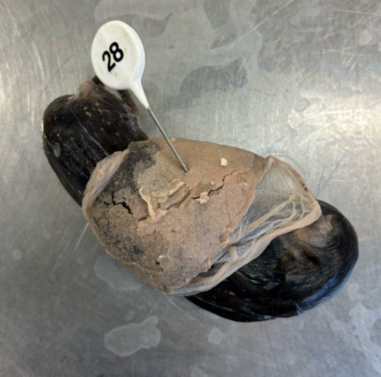 <p>Is this structure maternal or placental?</p>