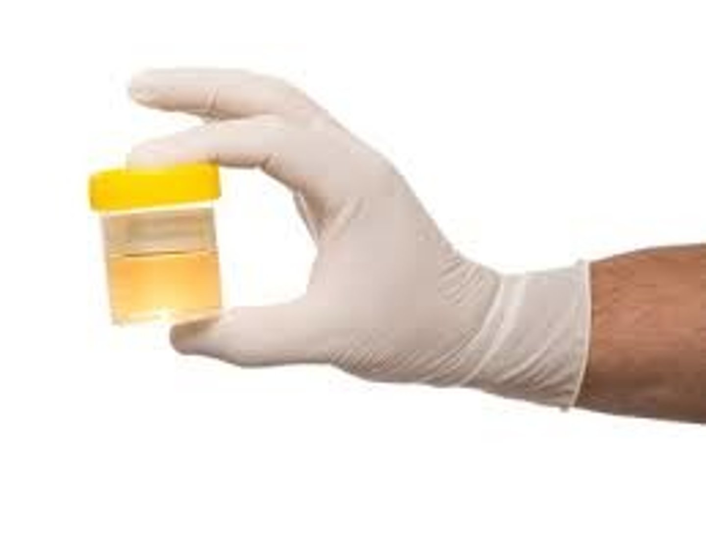 <p>______ is liquid waste that the body expels.</p>