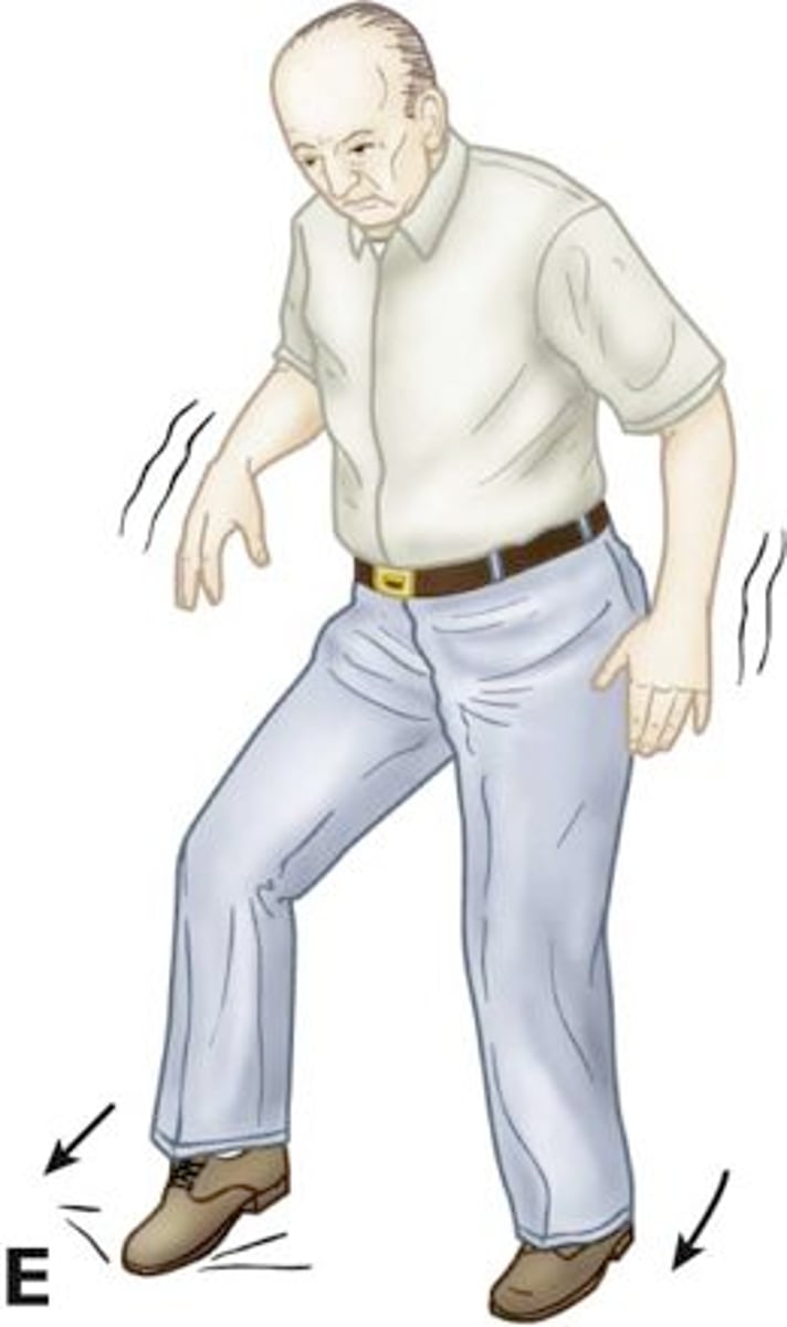 <p>a condition where a person cannot control their movements well (a- = without, tax = coordination, and -ia = condition).</p>