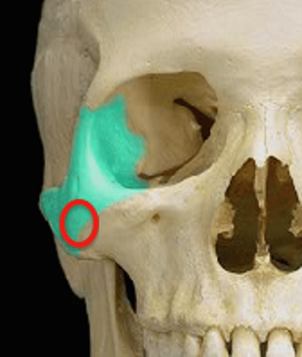 <p>articulates with zygomatic process of maxillary bone</p>