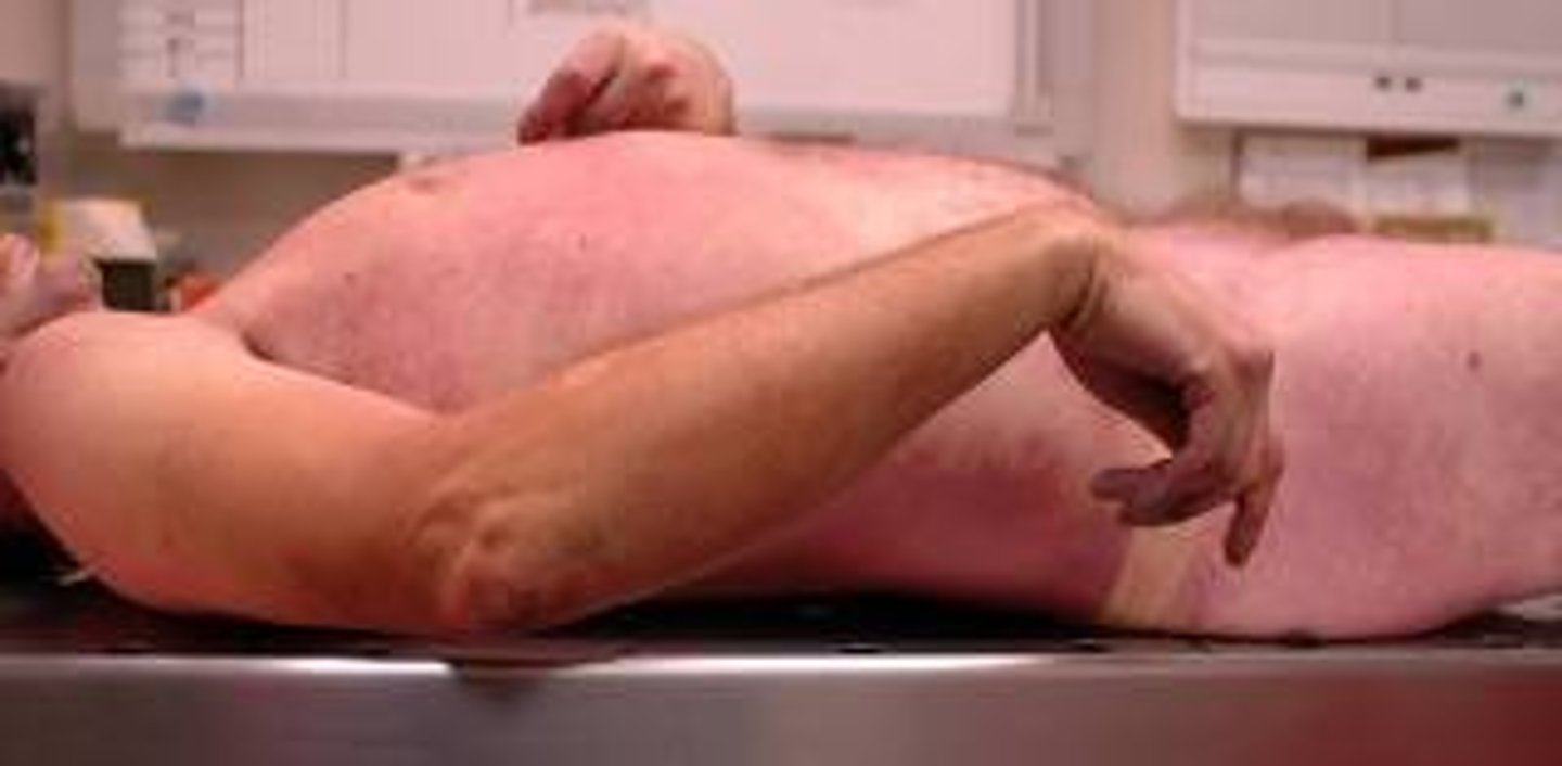 <p>Muscle stiffness occurs after death because there is no supply of energy to pump calcium back into the endoplasmic reticulum</p>