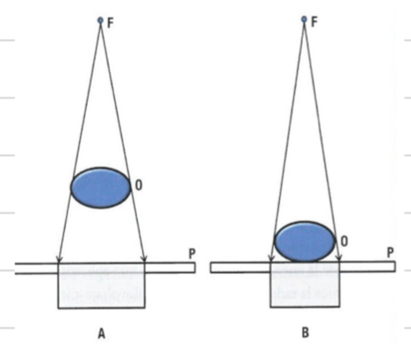 <p>the distance between the object being imaged and the film cassette</p>