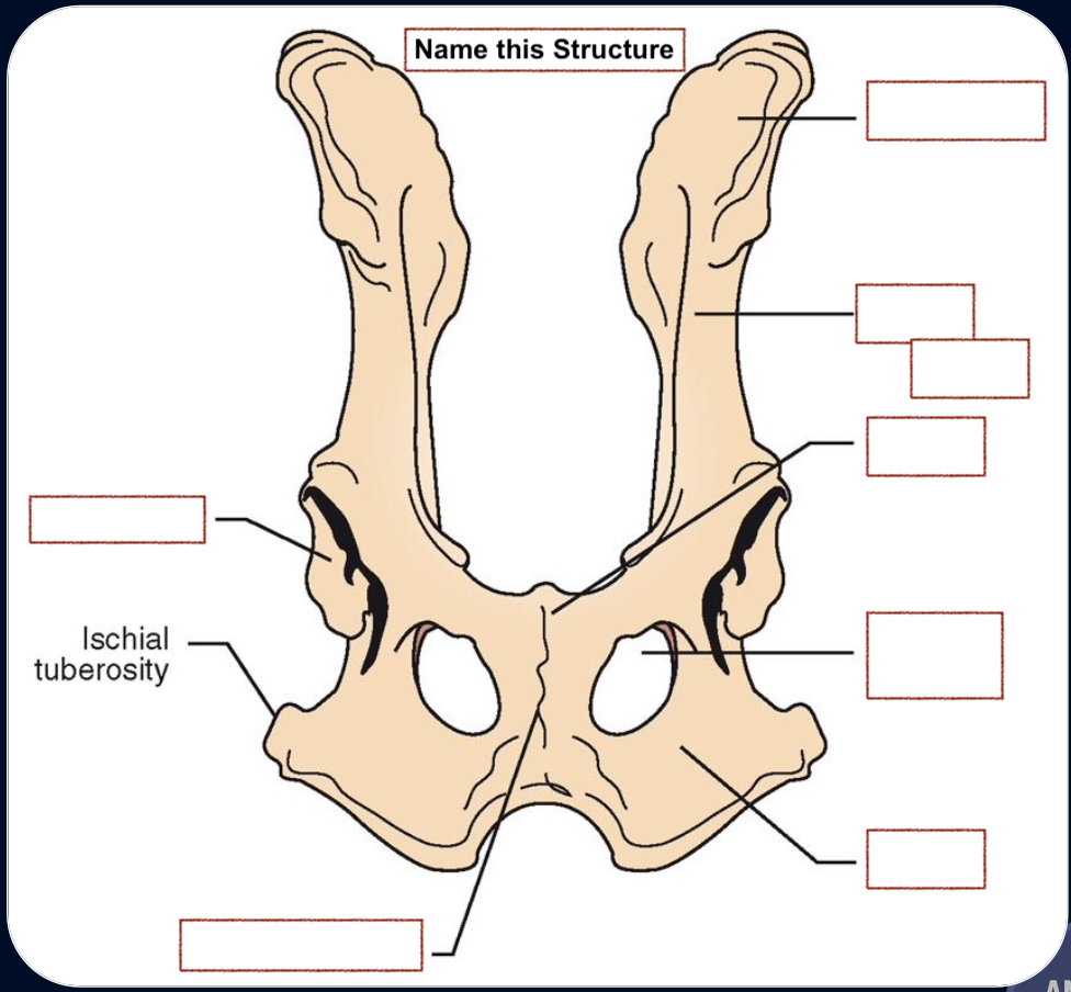 <p>Ilium</p><p>Wing of ilium</p><p>Pubis</p><p>Acetabulum</p><p>Obturator foramen</p><p>Ischium</p><p>Pubic Symphysis</p>