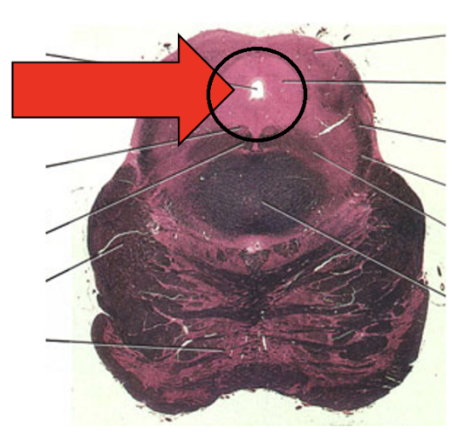 <p>Match the following structures/nuclei with the neurotransmitters they produce or respond to.</p><p>The group of neuronal cell bodies pointed by the arrow (area in the black circle)</p><p>A. Endorphins / endogenous opioids</p><p>B. Acetylcholine</p><p>C. Dopamine</p><p>D. Serotonin</p>