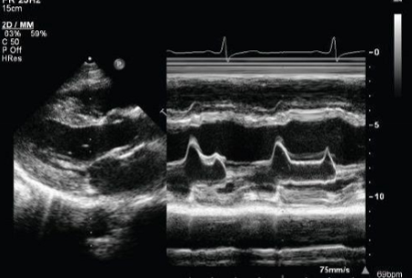 <p>Describe the rhythm of this patient.</p>