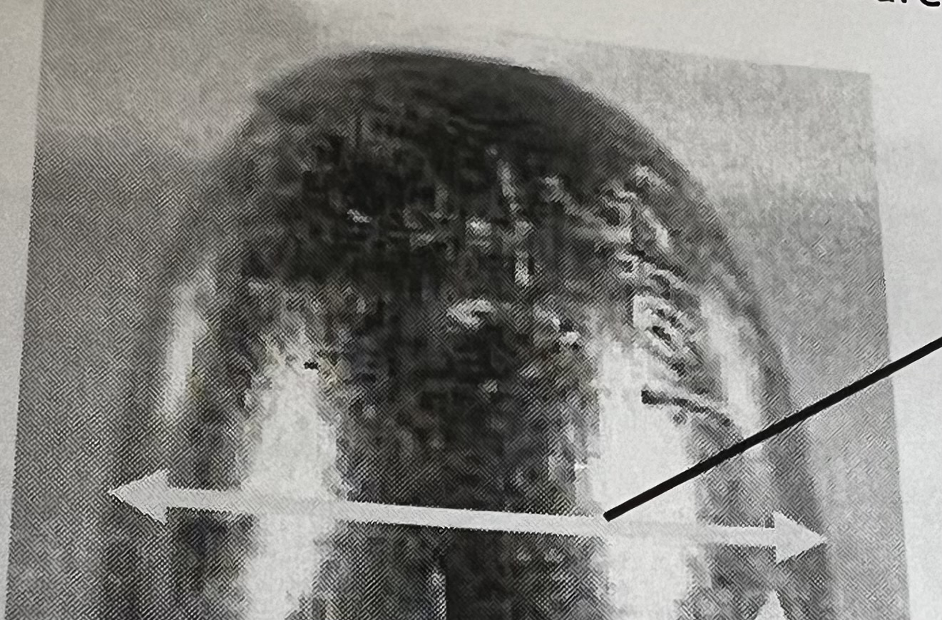 <p>What general rifling characteristic is this? </p>