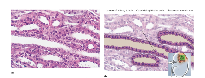 <p>Simple cuboidal epithelium</p>