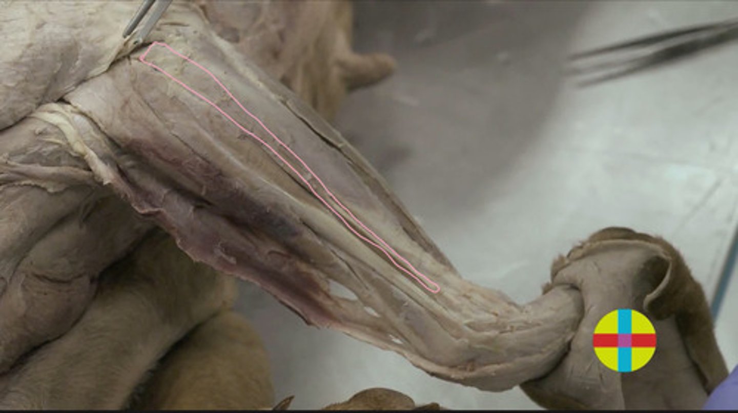 <p>se localiza entre los músculos extensor digital común y extensor cubital del carpo. </p><p>Origen: Epicóndilo lateral húmero</p><p>Inserción: segunda falange </p><p>Función: Extensor y fijador carpo y de los dedos Inervación: n. radial.</p>