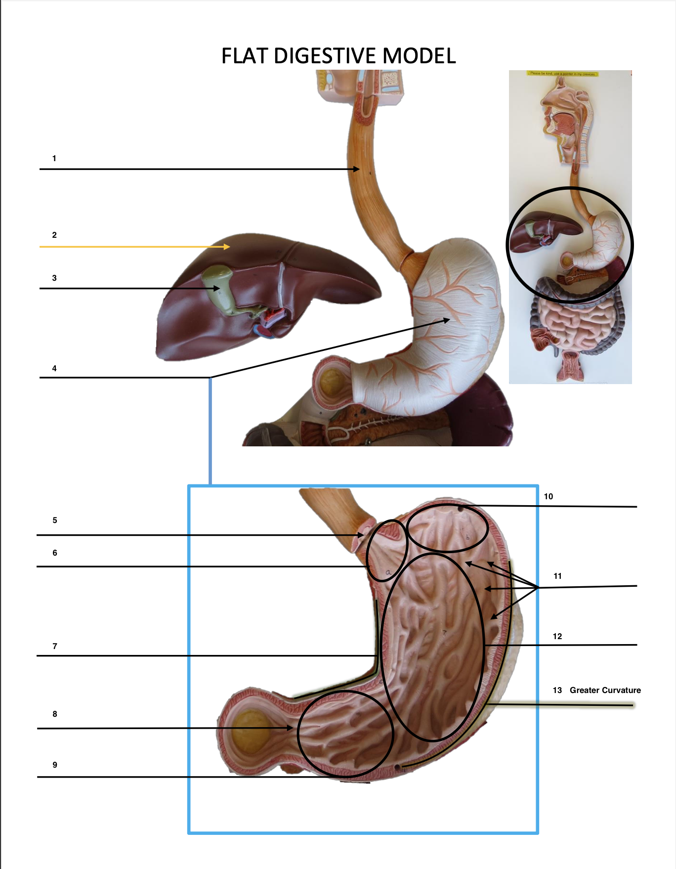 <p>Greater Curvature</p>