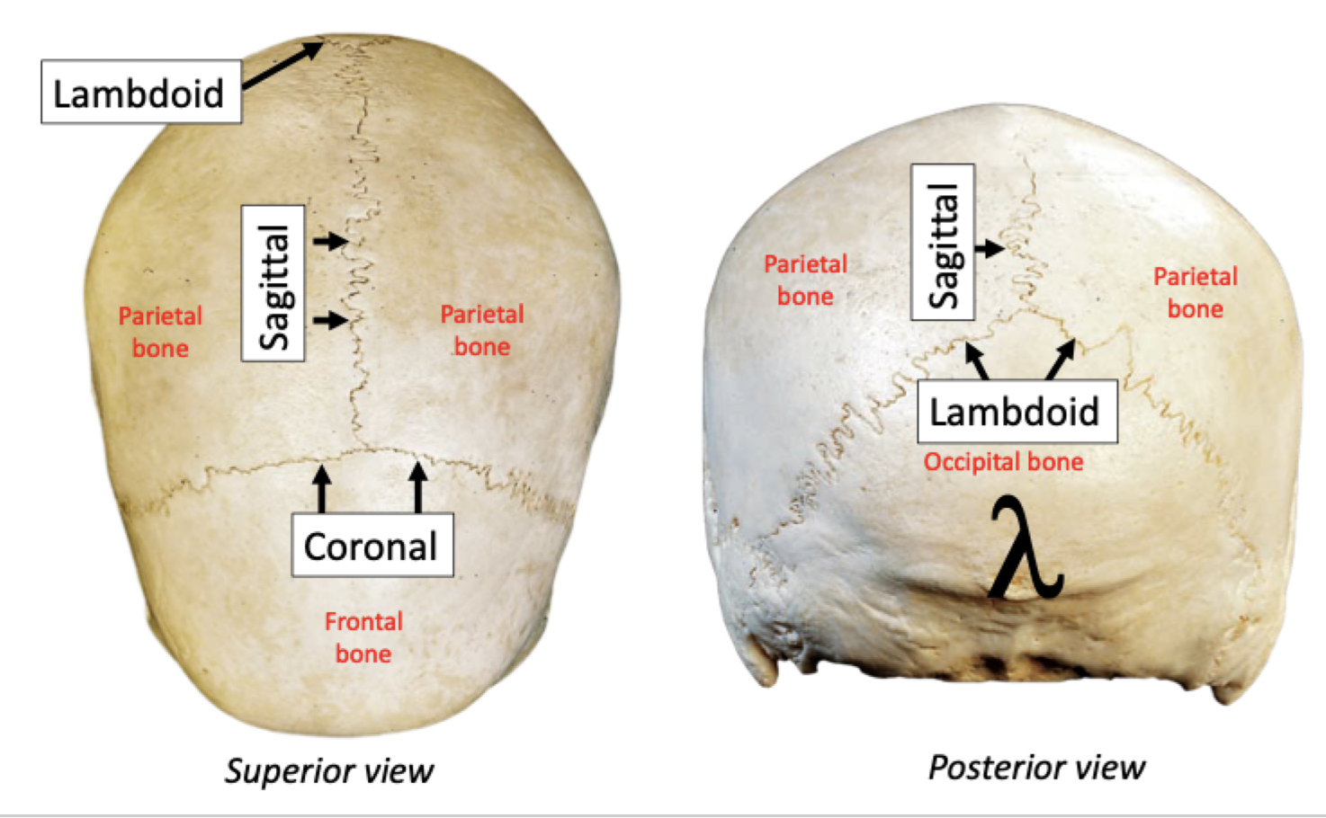 <ul><li><p>﻿﻿Boundaries between skull bones</p></li><li><p>﻿﻿Fibrous, immovable joints</p></li></ul>