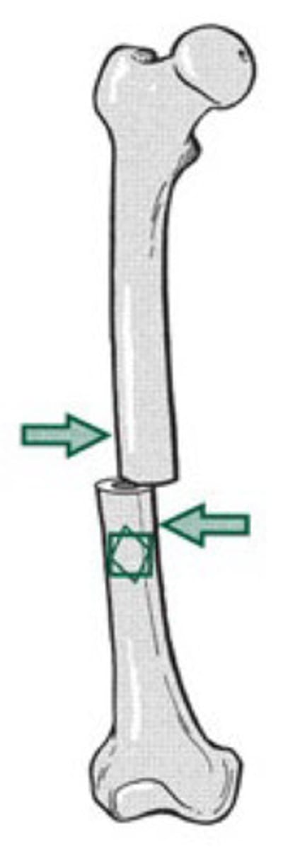 <p>sliding or tearing force directed parallel to the surface; internal deformation in angular direction</p>