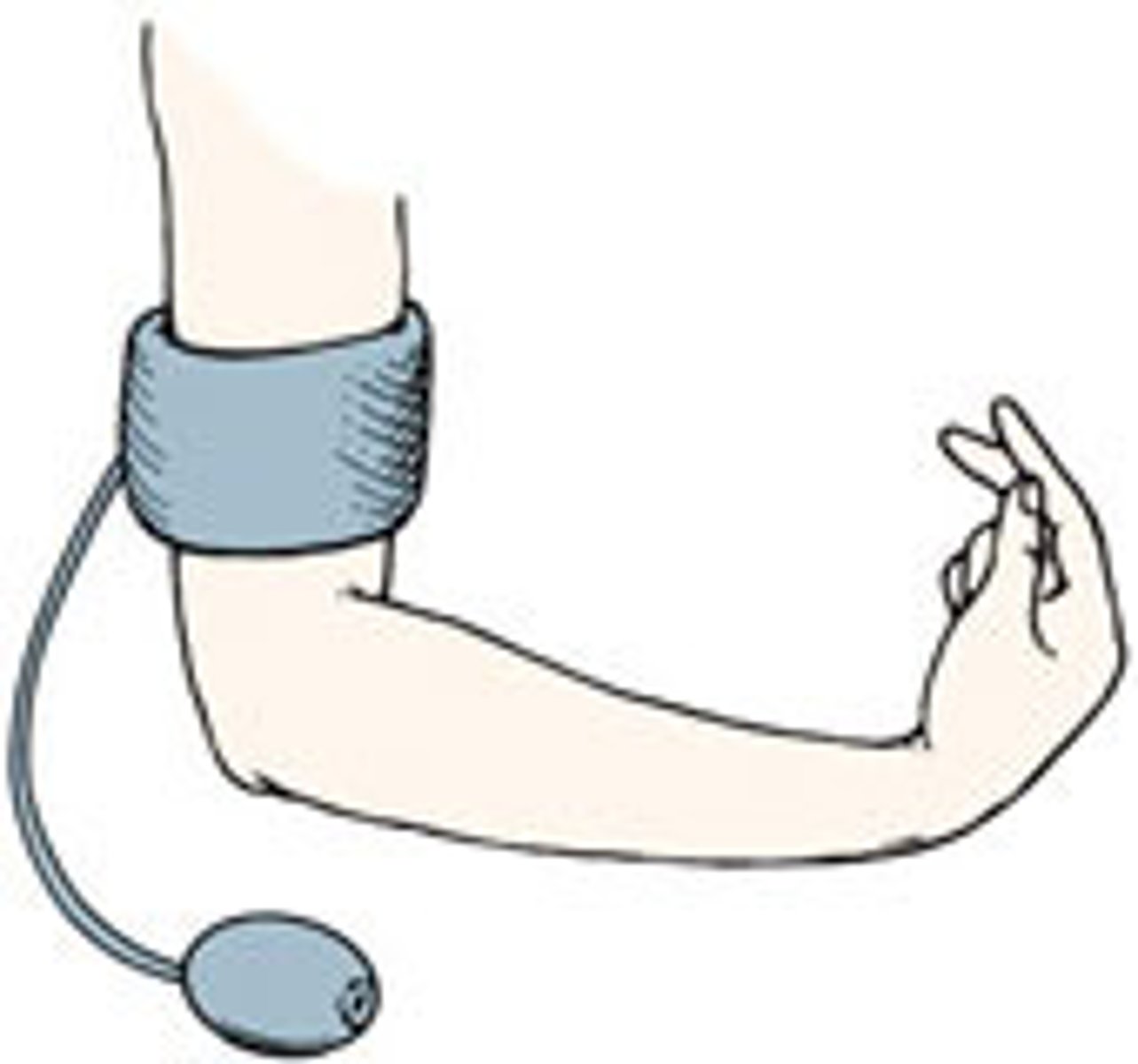 <p>Trousseau sign of latent tetany is a medical sign observed in patients with low calcium.<br><br>To elicit the sign, a blood pressure cuff is placed around the arm and inflated to a pressure greater than the systolic blood pressure and held in place for 3 minutes. This will occlude the brachial artery. In the absence of blood flow, the patient's hypocalcemia and subsequent neuromuscular irritability will induce spasm of the muscles of the hand and forearm.</p>