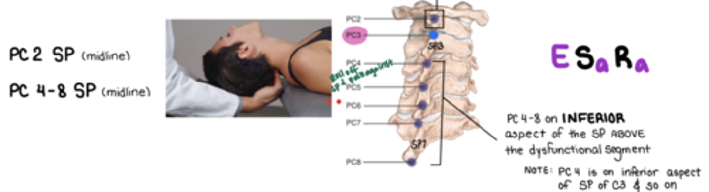 <p>E Sa Ra</p><p>3- middle scalenes, longus capitis, longus colli</p><p>4-8 semispinalis capitis, multifidis, rotatores</p>