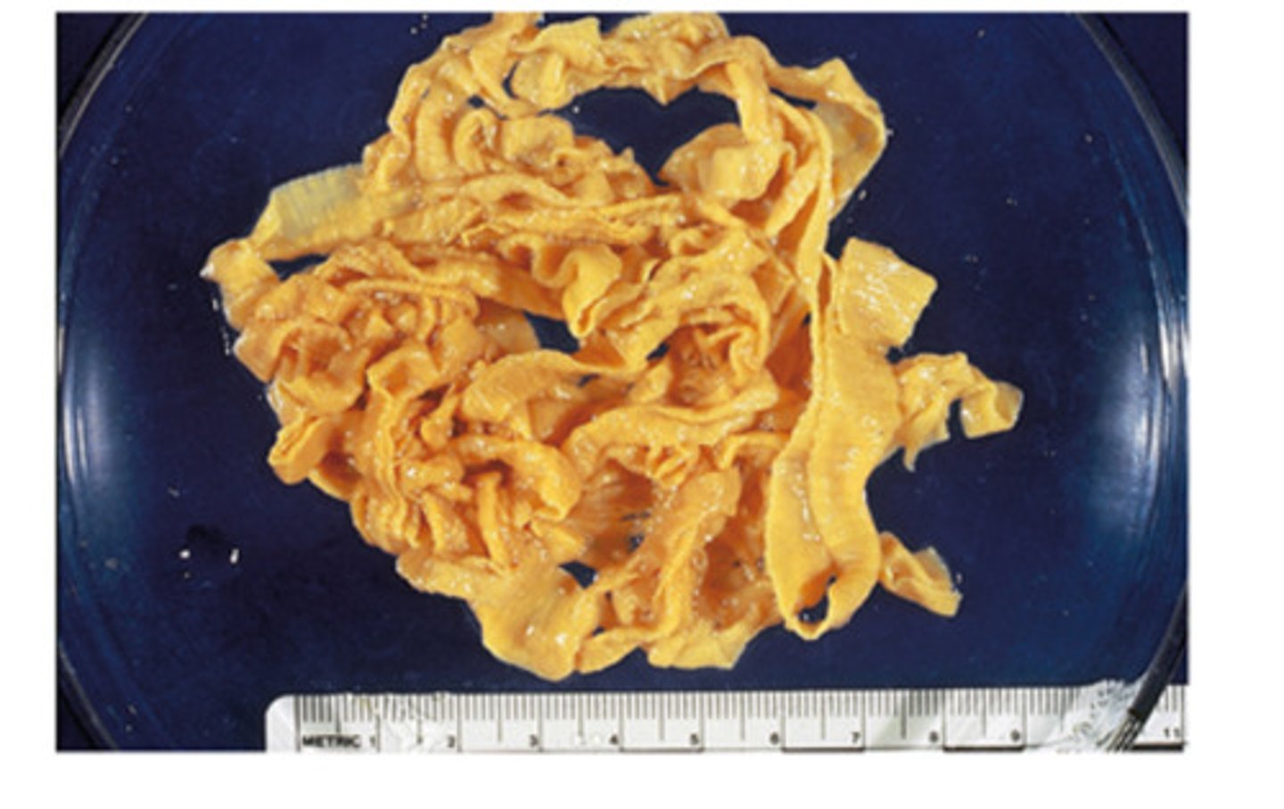 <p>This ruminant adult Cestode can grow up to 6 m in length. The adults are found in the __ of goats, sheep, and cattle</p>