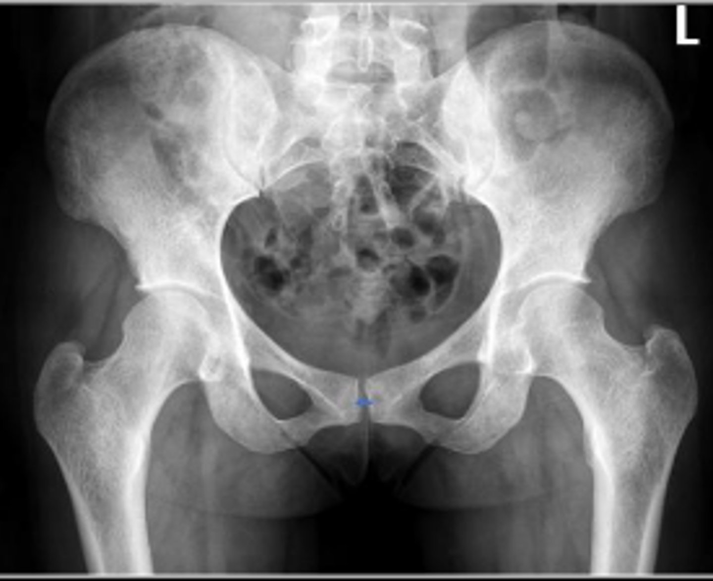 <p>What is the name of the assessment?</p>