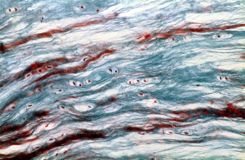 <p>Is this fibrocartilage, hyaline cartilage, or elastic cartilage?</p>