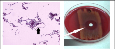 <p>What is the primary clinical significance associated with this organism?</p>