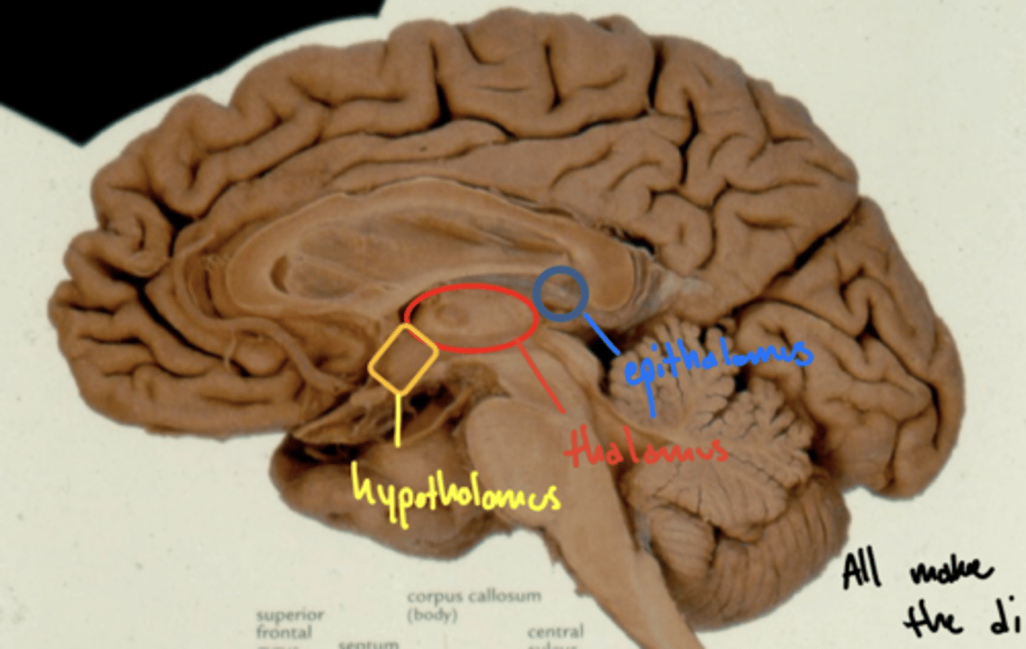 <p>anteroinferior (in front and below)</p>