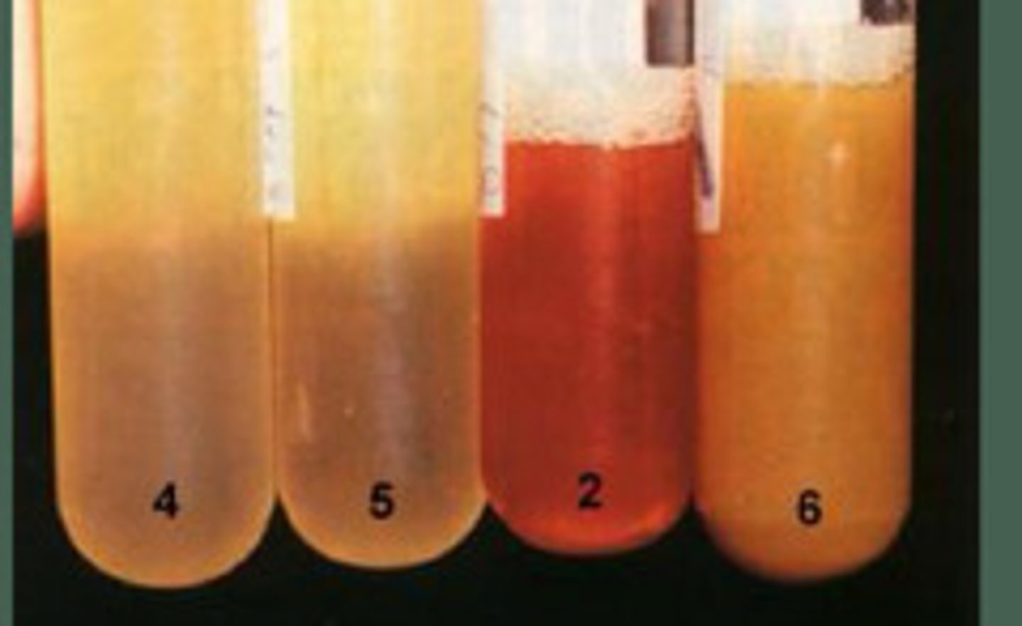 <p>You are an equine surgeon and a colleague referred you a horse with colic. He felt small intestinal distention on rectal exam and got the peritoneal fluid which is in the "4" image. You see the horse a couple hours later and get the sample labeled "2". Does this horse need surgery?</p>