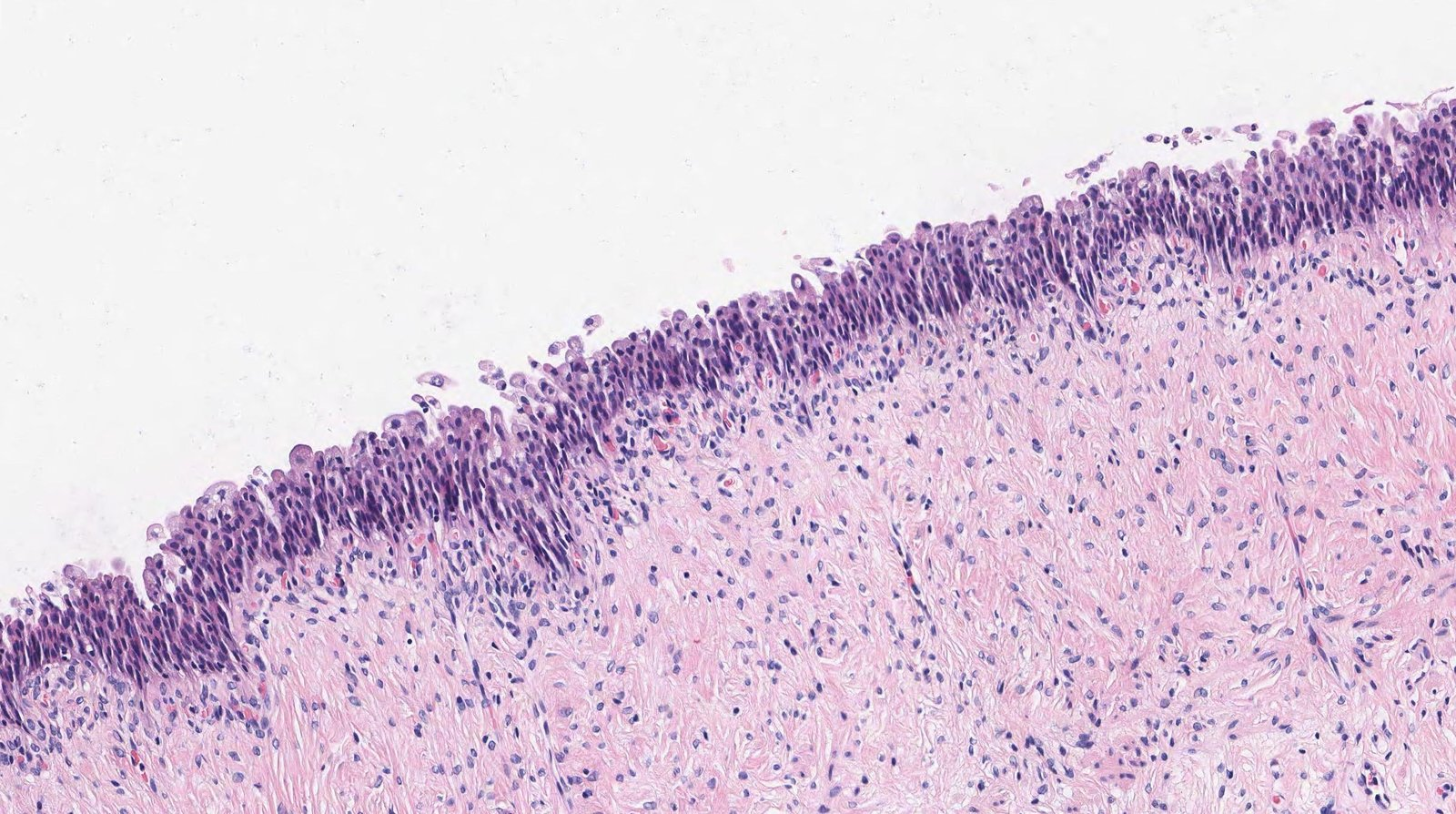 <p>E. The superficial cell layer of the epithelium contains uroplakins.</p>