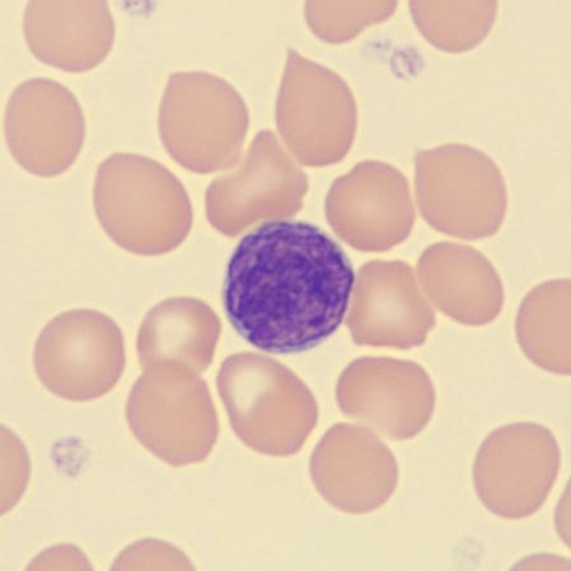 <p>What is this leukocyte?</p>