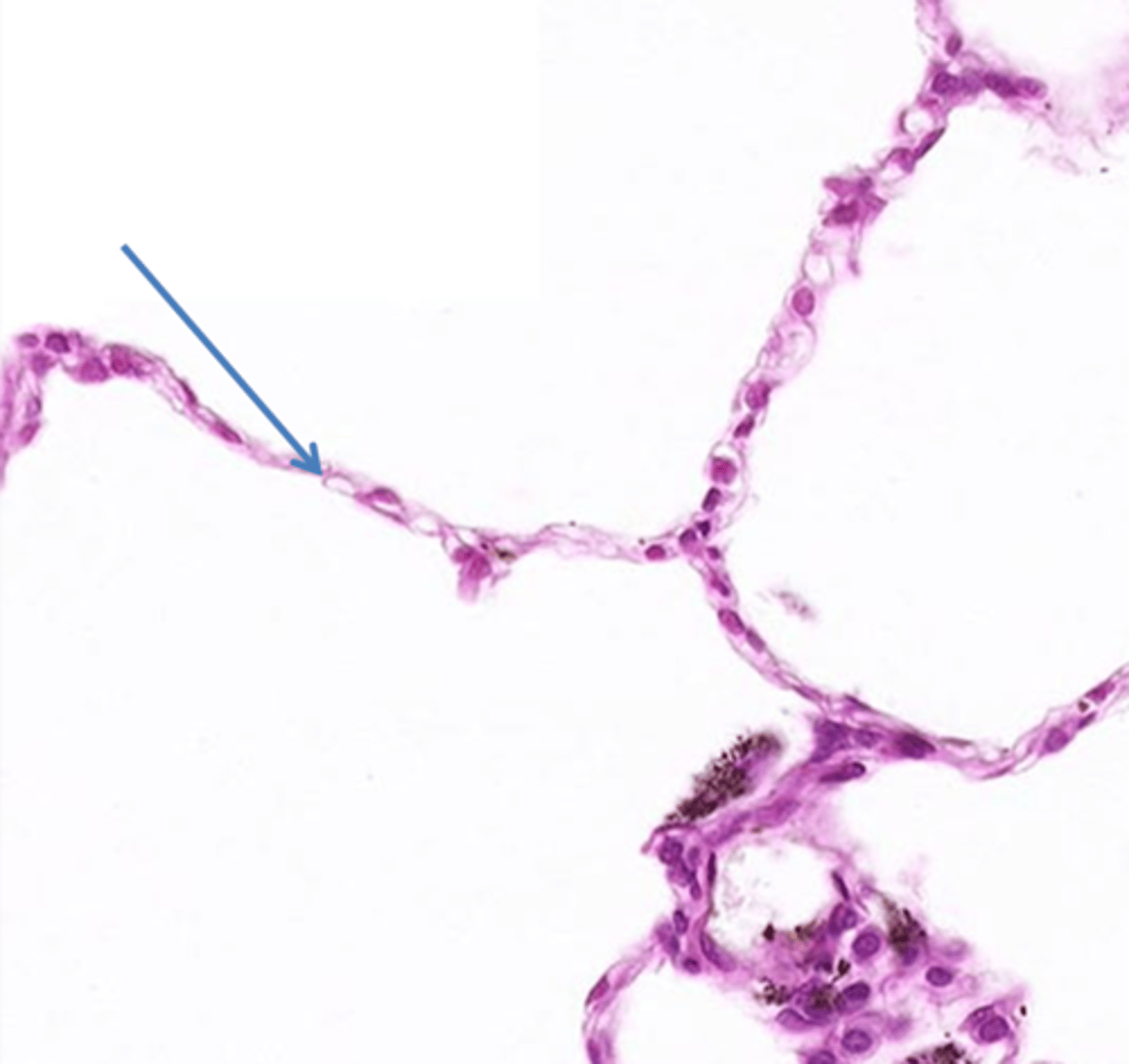 <p>Identify this specific tissue type lining the alveoli.</p>