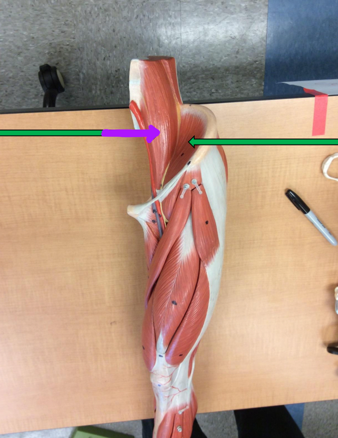 <p>Identify this muscle?</p>