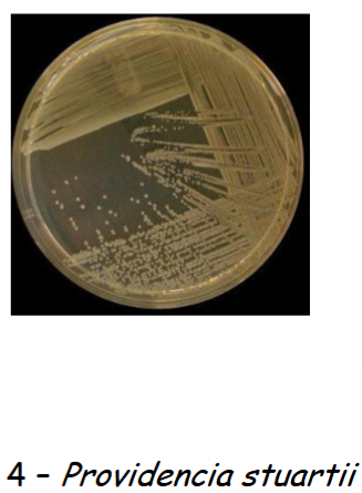 <p>clear, colorless and non lactose fermenter (-). Gram positive</p>