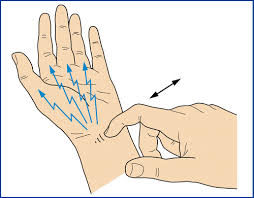 <p><strong>A nurse working in a busy orthopedic clinic is asked to perform the Tinel sign on a patient having problems in his hand/wrist. In order to test Tinel sign, the nurse should give the patient which of the following directions?</strong></p><p>A) “Stand tall, arms at your side, shut your eyes; place the tip of your index finger to your nose.”</p><p>B) “Hold your wrist in complete flexion; keep it in this position for 60 seconds; how does your hand feel after placing it in a neutral position?”</p><p>C) “I'm going to tap (percuss) over the median nerve in your wrist; tell me what sensation you feel while I am doing this. Does the sensation stay in the wrist or go anywhere else?”</p><p>D) “I'm going to tap this tuning fork and place it on the side of your thumb; then tell me what you are feeling in your hand and wrist.”</p>