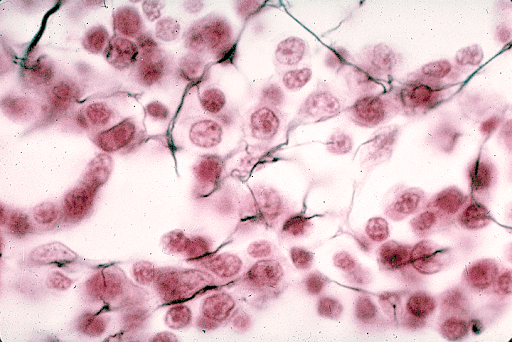<p>Which of the three fibrous connective tissues is this a picture of?</p>