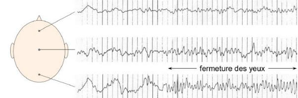 -la fermeture des yeux produit une augmentation marquée de l’amplitude du rythme alpha (8-
12Hz) en regard des aires visuelles occipitales. L’amplitude du rythme alpha est le rythme de repos.
-Dans les aires somatosensorielles et motrices primaires, la réalisation de mouvement de la main entraîne une réduction du rythme alpha en regard de la représentation corticale de la main et une augmentation du rythme alpha en regard de la représentation corticale du pied.
-À l’inverse, la réalisation de mouvement du pied entraîne une augmentation du rythme alpha en regard de la représentation corticale de la main et une diminution du rythme alpha en regard de la représentation
corticale du pied