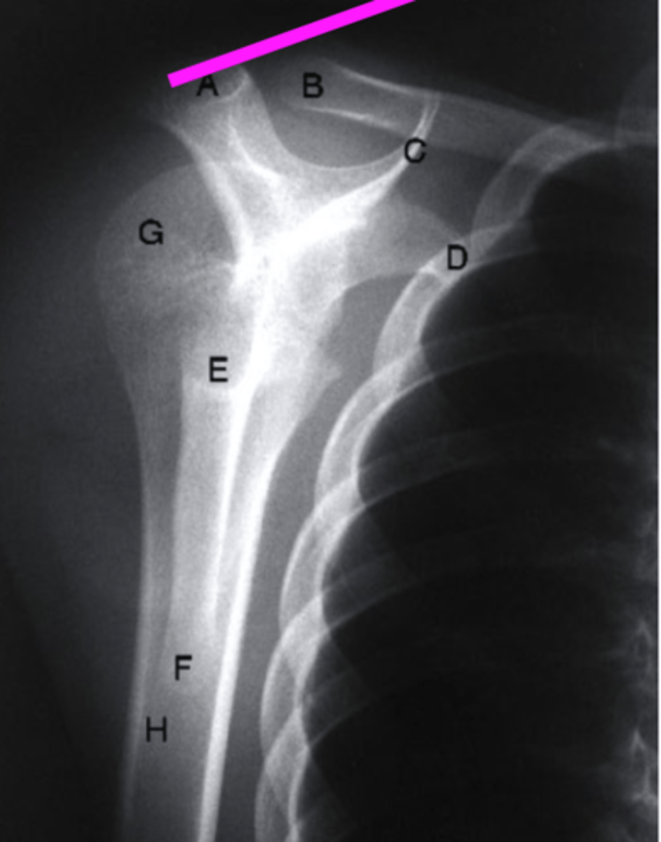 <p>what does the pink line point to?</p>
