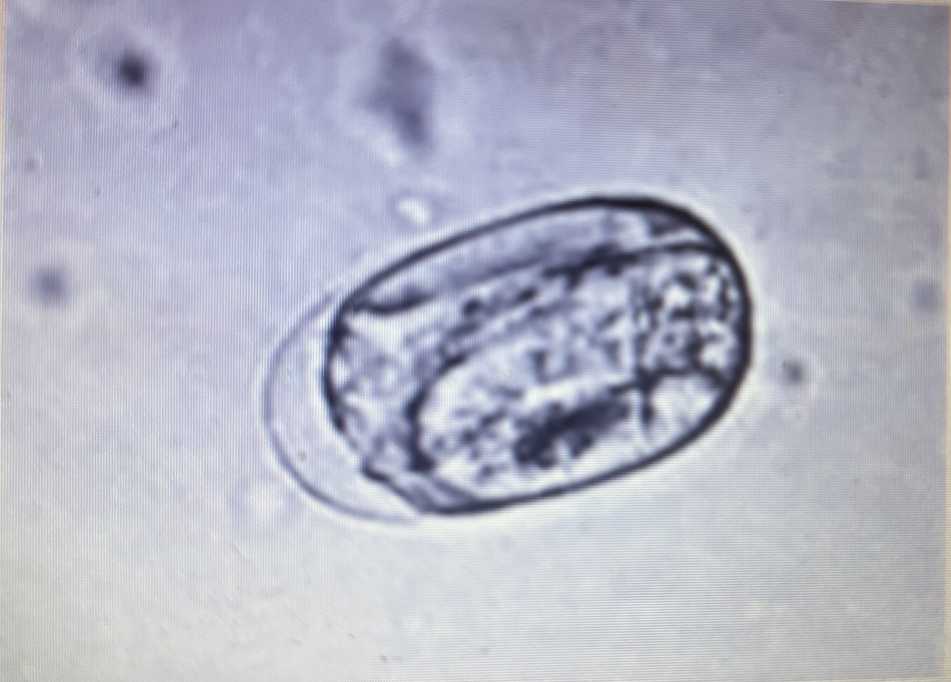 <p>Parthenogenic female parasites - asexually reproducing female parasites affecting horses</p>