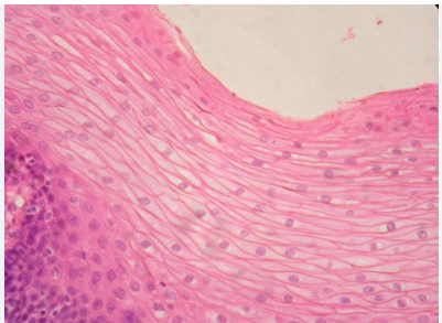 <ul><li><p>basal surface has cubed shaped cells </p></li><li><p>cells of apical surface are flattened </p></li><li><p>found as a protective covering where friction is common </p></li><li><p>skin/ mouth/ esophagus </p></li></ul><p></p>