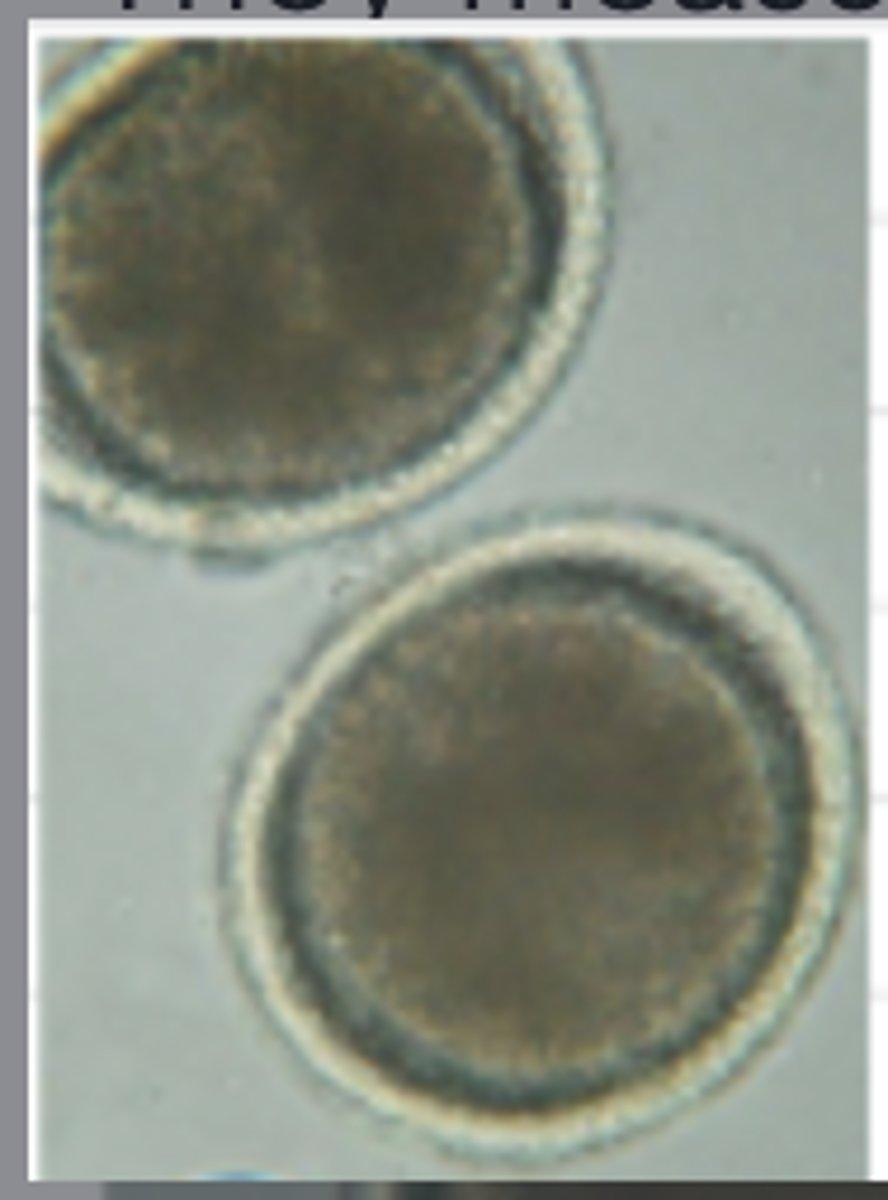 <p>These eggs were found on the fecal flotation of a 9-week-old Miniature Schnauzer puppy presenting for its vaccinations and an initial physical examination. They measure approximately 85 micrometers in diameter. What is the diagnosis?</p>
