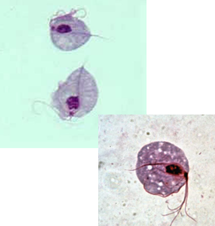 <ul><li><p style="text-align: justify;"><span style="background-color: transparent;"><span>Identify the organism. Give genus and species.</span></span></p><ul><li><p style="text-align: justify;">(1)</p></li></ul></li><li><p style="text-align: justify;"><span style="background-color: transparent;"><span>What is the morphologic stage of the organism?</span></span></p><ul><li><p style="text-align: justify;">(2)</p></li></ul></li><li><p style="text-align: justify;"><span style="background-color: transparent;"><span>What is the characteristic motility pattern?</span></span></p><ul><li><p style="text-align: justify;">(3)</p></li></ul></li><li><p style="text-align: justify;"><span style="background-color: transparent;"><span>What is the specimen of choice for the detection of the organism?</span></span></p><ul><li><p style="text-align: justify;">(4)</p></li></ul></li></ul><p></p>