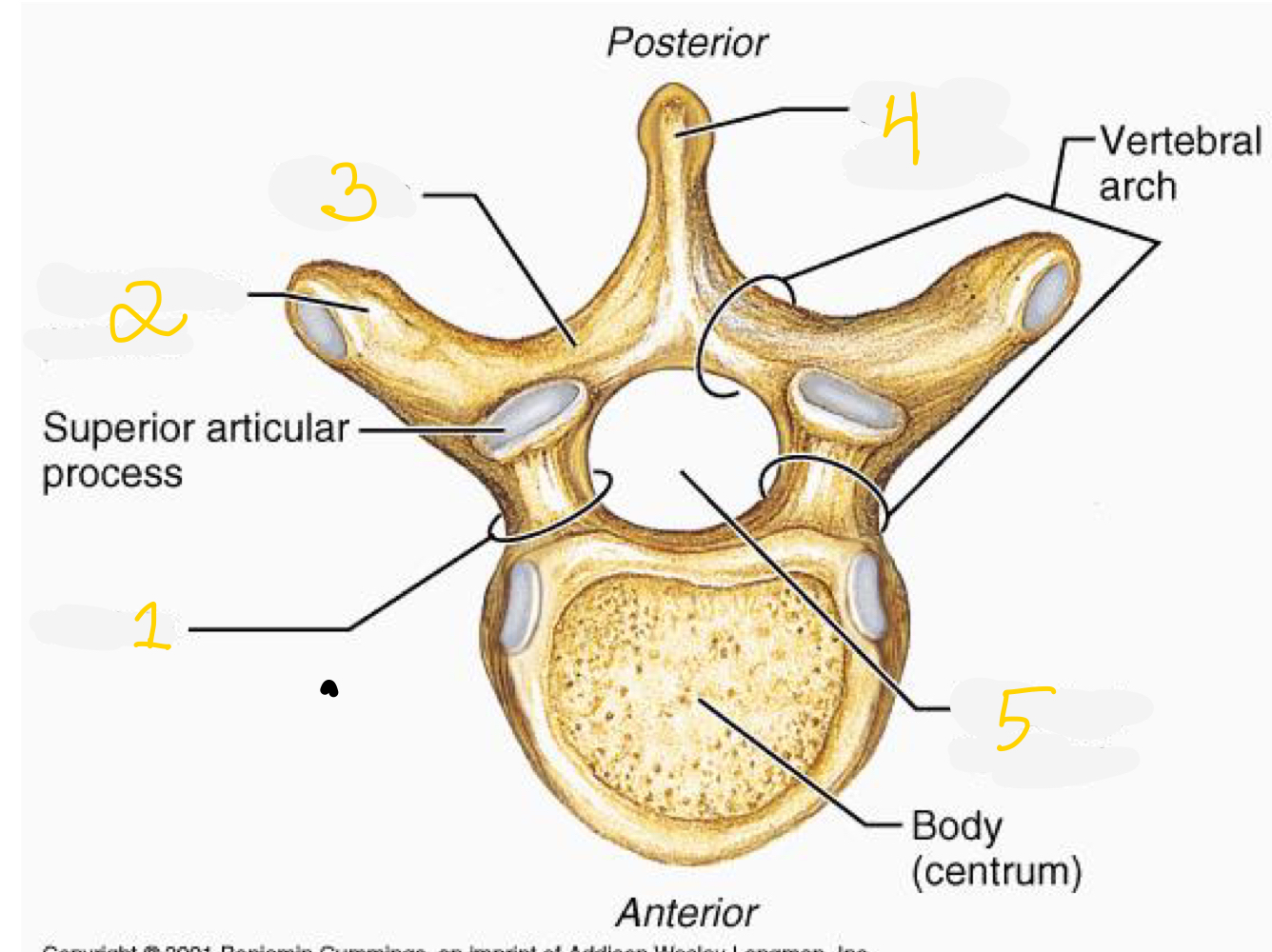 What part of the vertebrae is indicated by number 1 in the image?