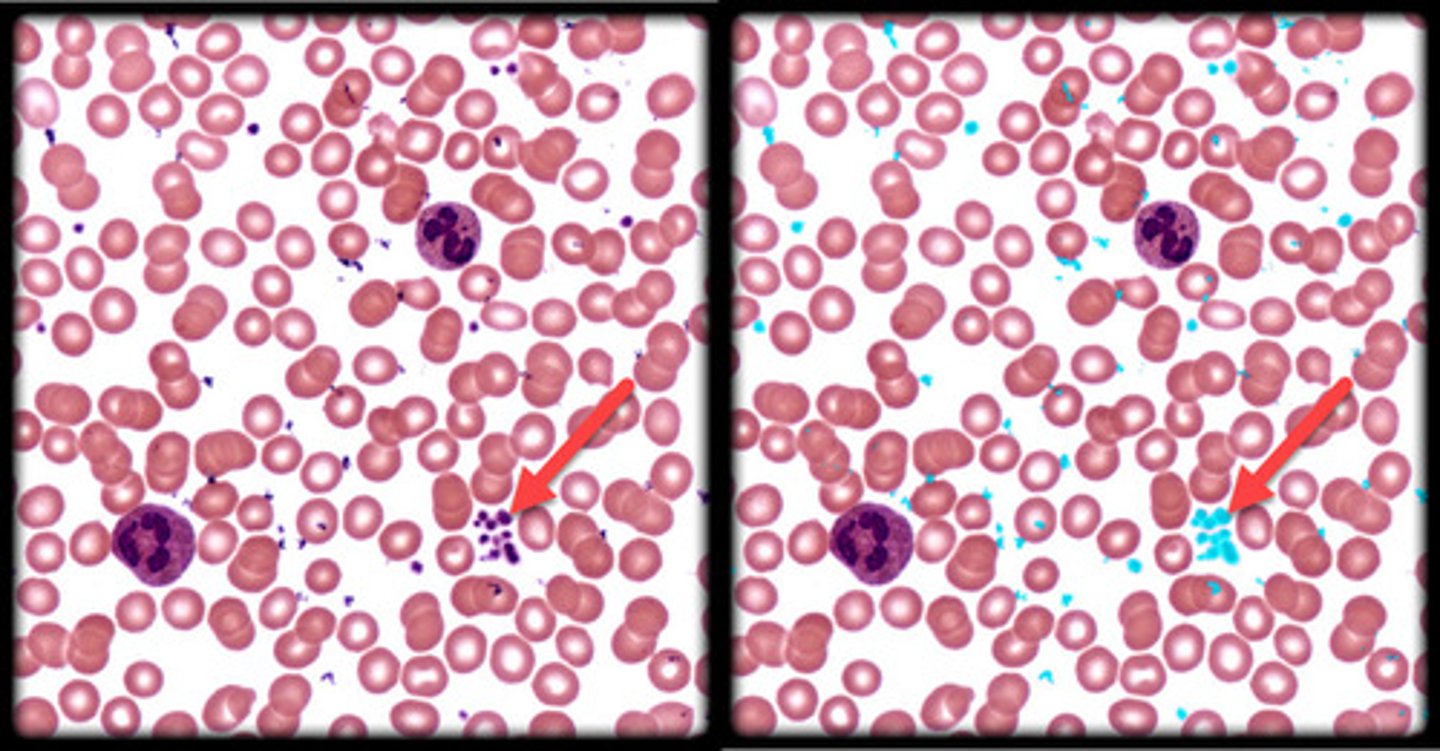 <p>- Tiny, cell fragments involved in blood clotting.</p><p>- Appear as small, dark dots scattered among red and white blood cells.</p>