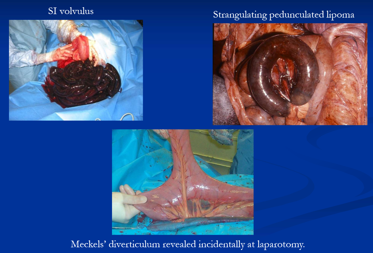 <ul><li><p>strangulating <strong>pedunculated mesenteric lipoma </strong></p><ul><li><p>mature horses, especially older overweight mares </p></li></ul></li><li><p>small intestinal <strong>volvulus; </strong>all ages, unknown etiology </p></li><li><p>strangulation / torsion / volvulus associated with Meckels diverticulum </p></li><li><p>these present as <strong>acute, persistent and progressive abdominal pain and require prompt surgical intervention </strong></p></li></ul><p></p>