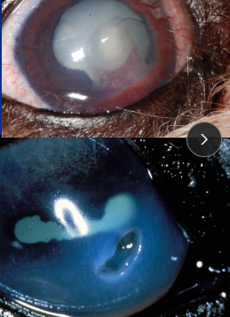 <p><span style="background-color: transparent;"><strong><span>Mid-Stromal Corneal Ulcer</span></strong></span></p>