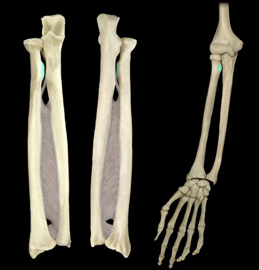 term image