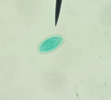 <p>Which structure is being shown?</p>