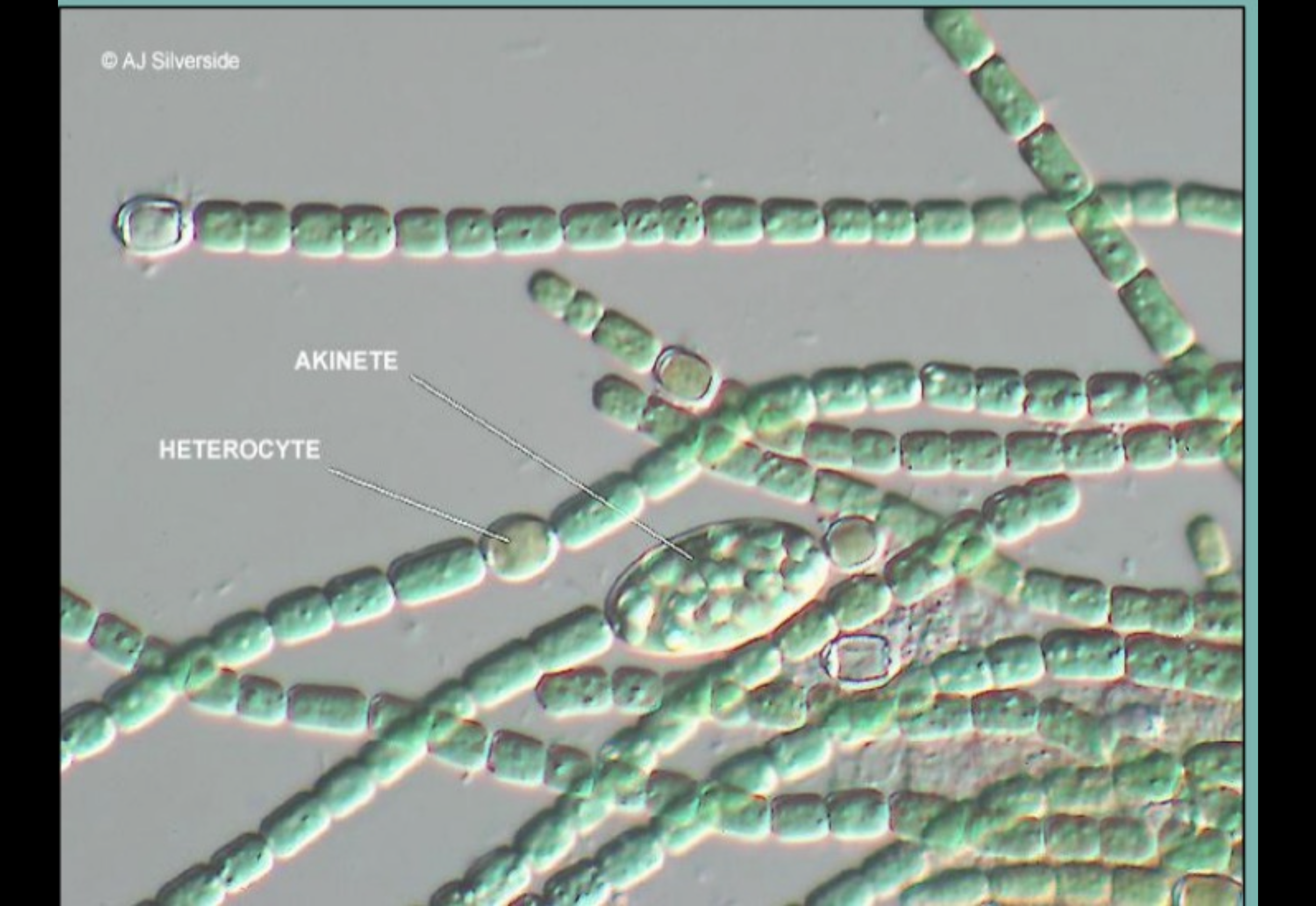 <p>Heterocyte and akinete</p>