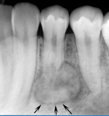 <p>most likely diagnosis?</p>